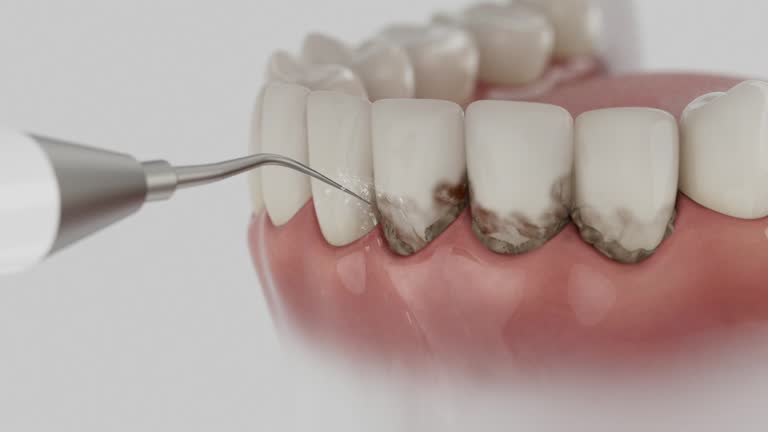Reliable Dental contractor in Utica, OH by Dentist Open Now